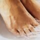 Best Oil to Soften Calluses