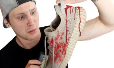 How to Get Blood Out of Shoes