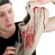 How to Get Blood Out of Shoes