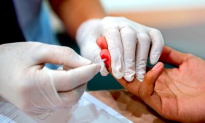 HIV testing