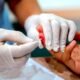 HIV testing