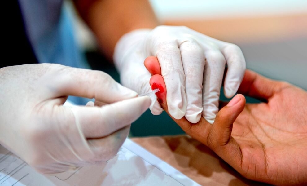 HIV testing