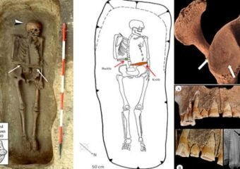 medieval warrior prosthetic knife discovery