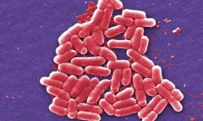 E. Coli Outbreak in Mesa County