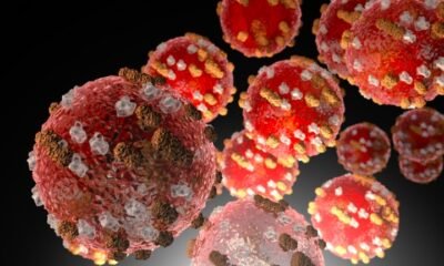 measles outbreak colorado 2025