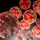 measles outbreak colorado 2025