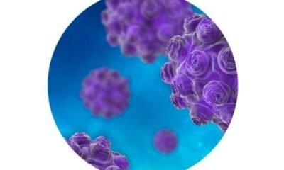 Mesa County measles, Grand Junction Love's Travel Stop,