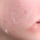 medication risks sun exposure
