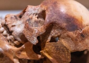 ancient skull archaeology