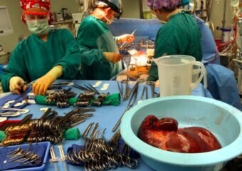 liver transplant patient