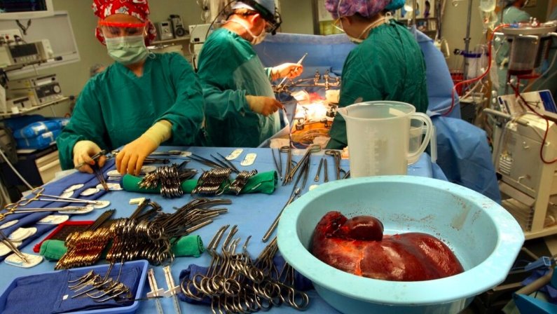 liver transplant patient