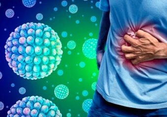 norovirus outbreak illustration
