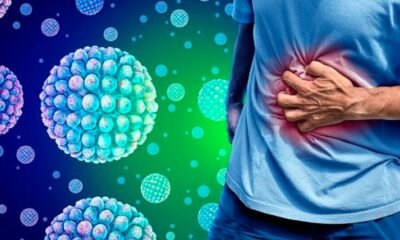 norovirus outbreak illustration