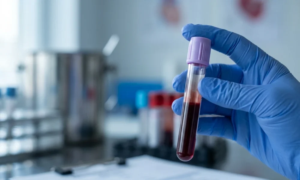 Colorectal cancer screening blood test guidelines explained for adults over 45.