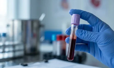 Colorectal cancer screening blood test guidelines explained for adults over 45.