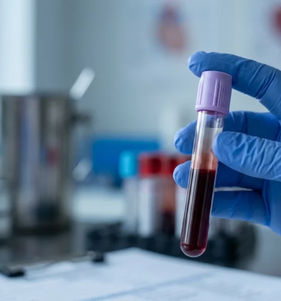 Colorectal cancer screening blood test guidelines explained for adults over 45.