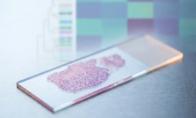 Genomic test spares node-positive breast cancer patients from chemotherapy in OPTIMA trial.